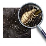 How-to-Get-Rid-of-Lice-Naturally_141497557